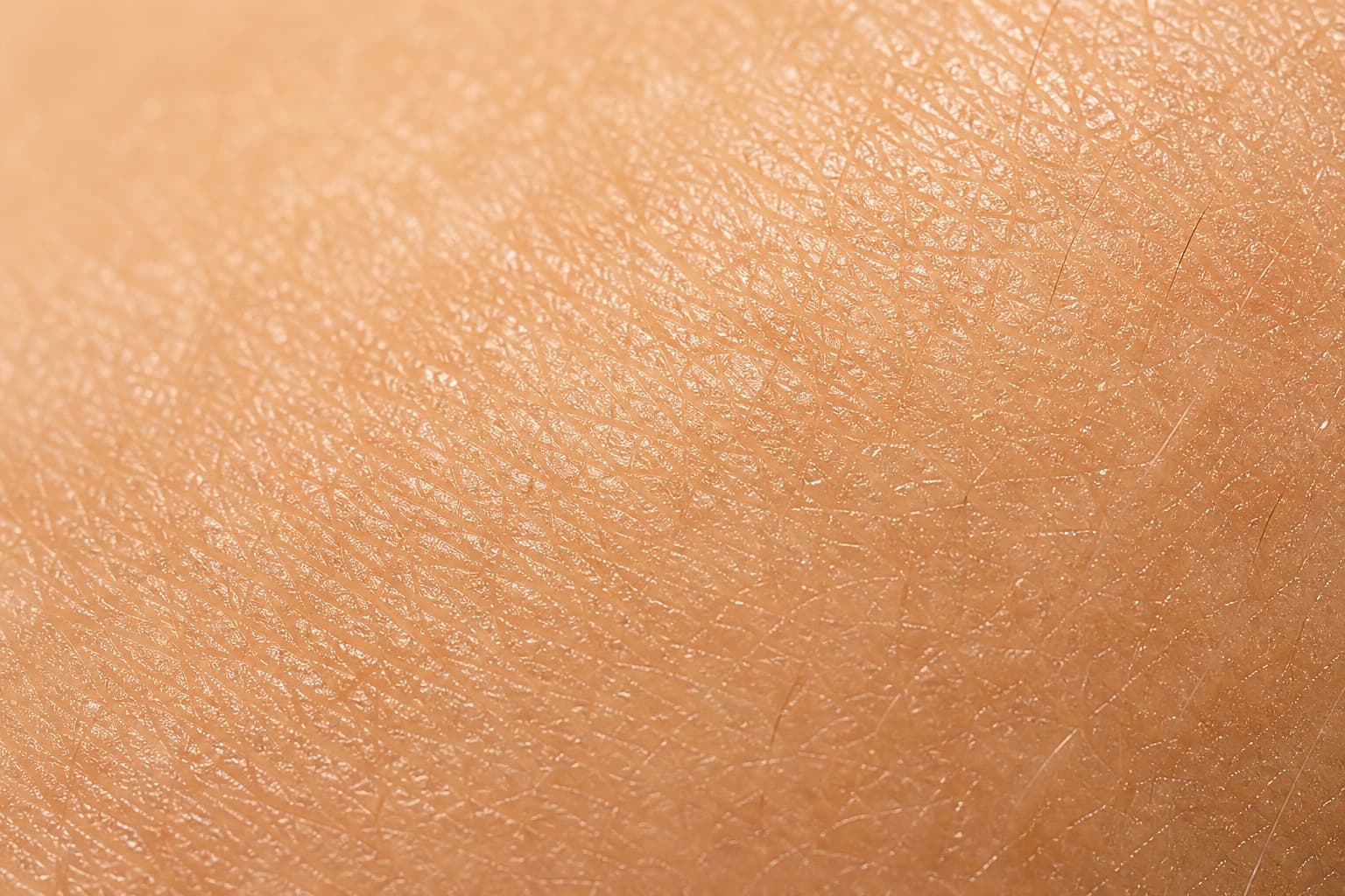 thermal-photoaging-collagen-breakdown